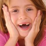 ¿Qué significa soñar con dientes o pérdida dental?